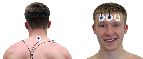 accessory and frontal placements